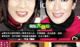 香港艺人整容爆料视频,揭秘背后真相与争议